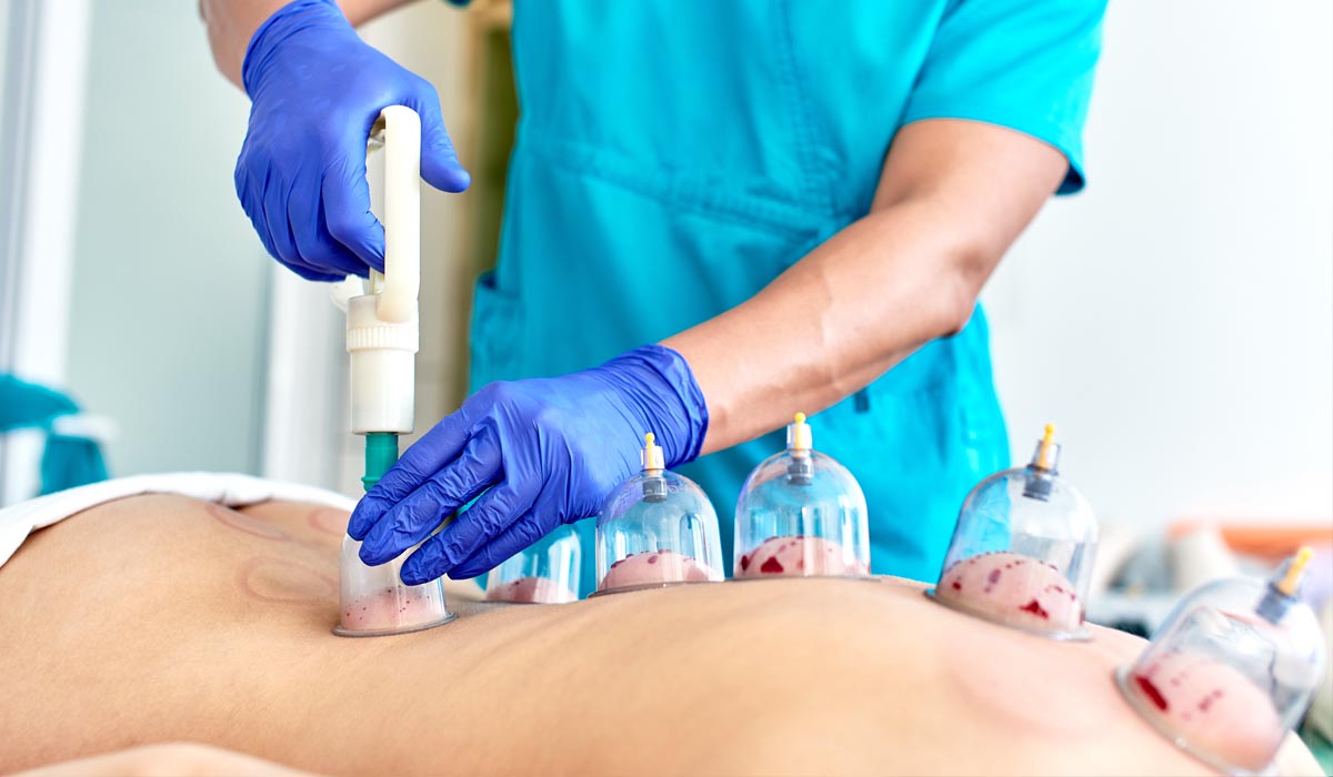 Diploma In Cupping Therapy